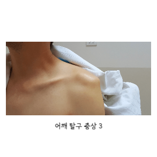 어깨통증원인