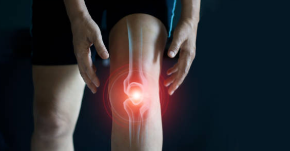 관절염 초기증상&amp;#44; 치료법&amp;#44; 관절염에 좋은 음식 총정리 (2024ver)