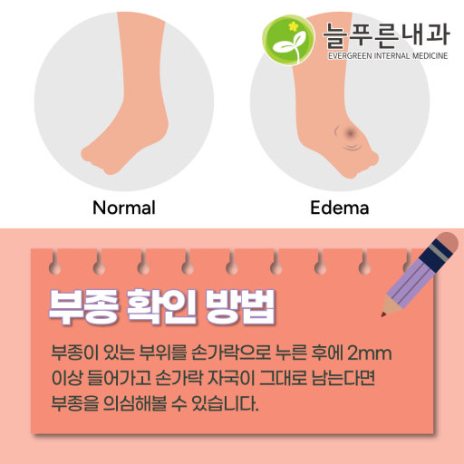 사진2