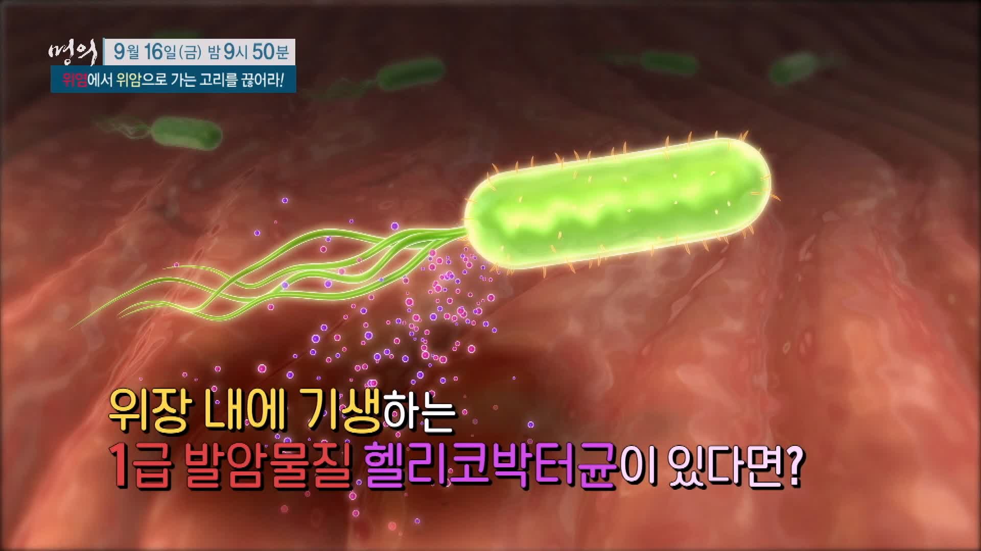 명의 소화불량, 만성 위염에서 위암으로 가는 고리 헬리코박터 균 치료 방법 삼성 서울 병원 김재준 교수 추천 소개