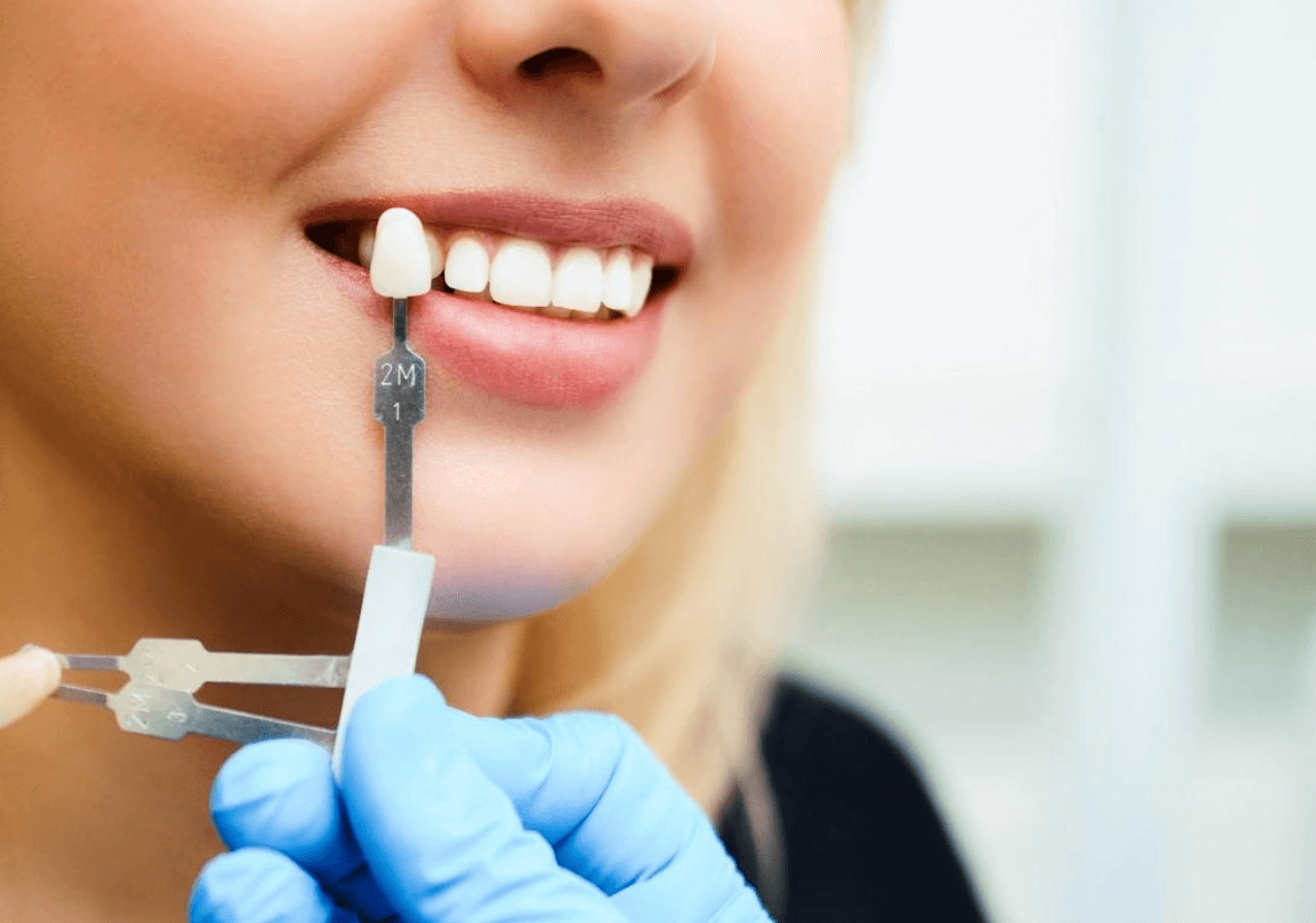 지르코니아 크라운 후기