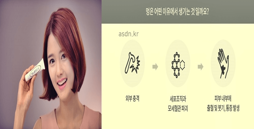베노플러스겔 효능 효과&#44;성분&#44;가격&#44;부작용 총정리