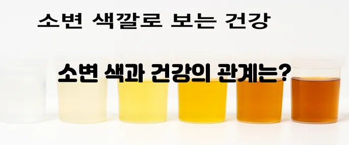 소변 색깔로 보는 건강 한번에 알아보기