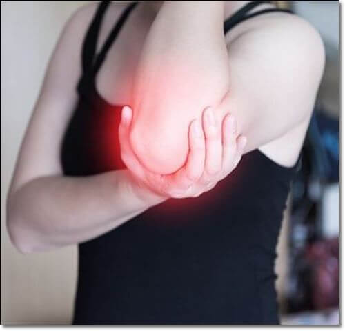 팔 관절염 환자