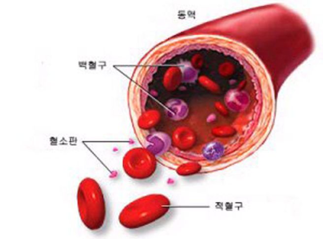 혈소판 수치가 낮으면