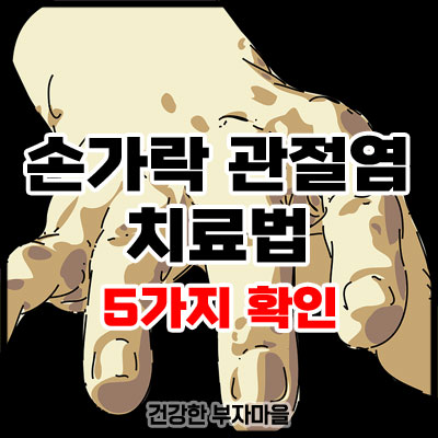 손가락 관절염 치료법