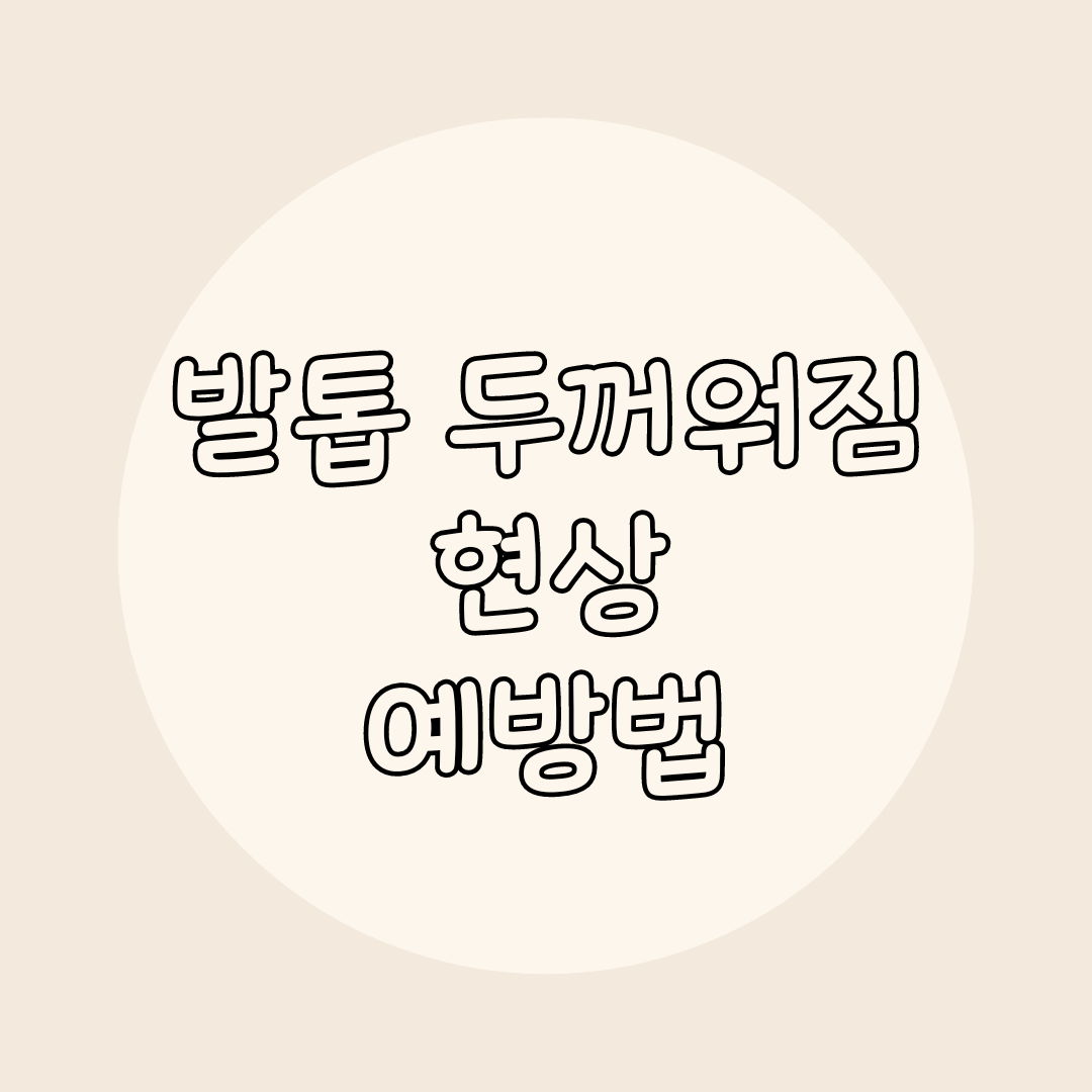 발톱 예방