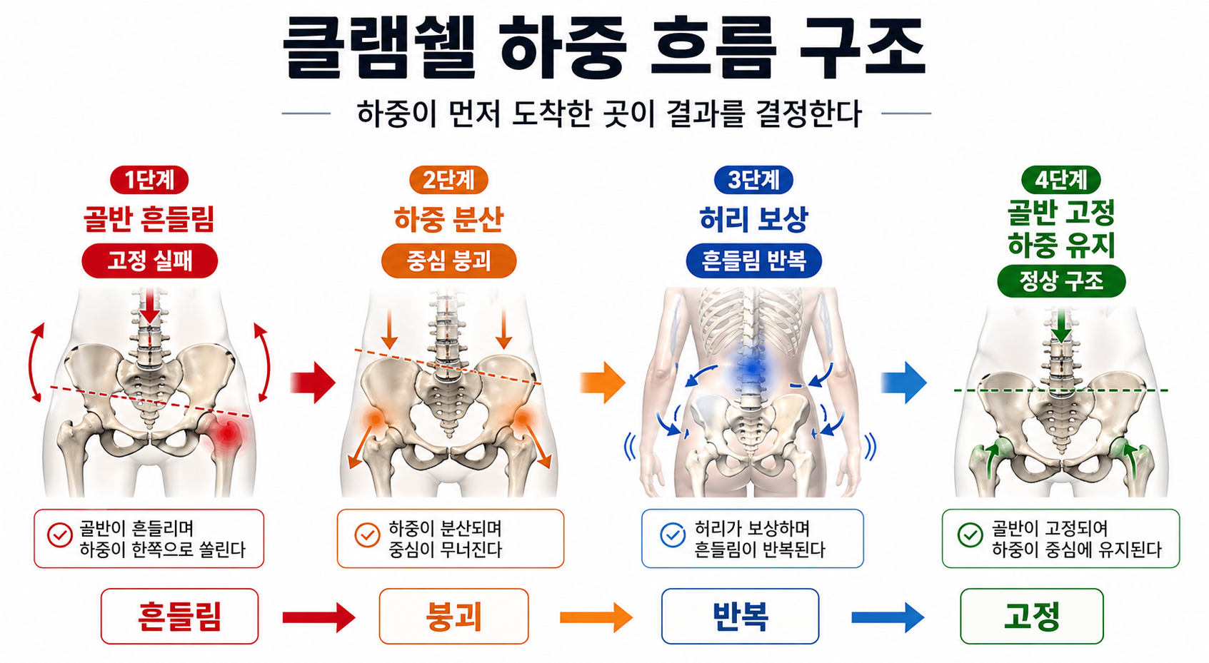 “클램쉘 하중 흐름 구조”