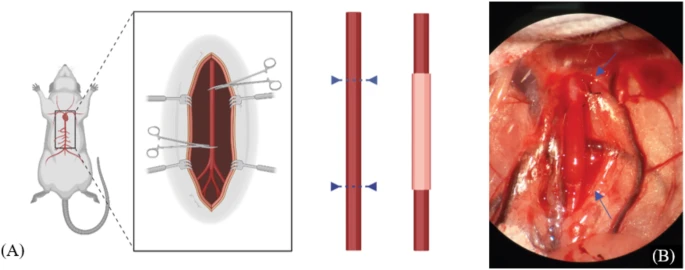 혈핵학-3D 프린팅 기술을 활용한 인공혈관 내 혈전 형성 연구