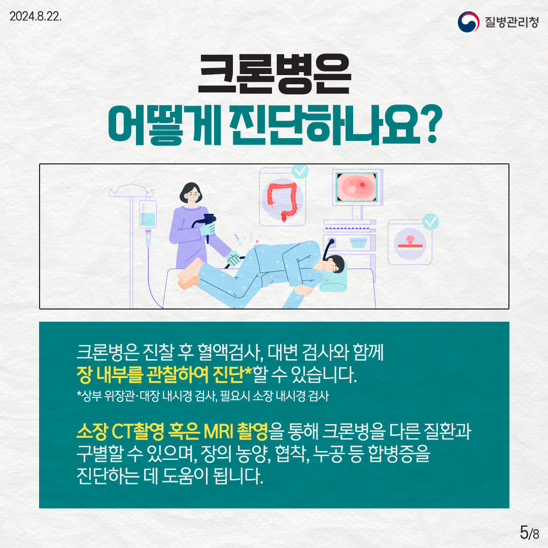 크론병-진단법