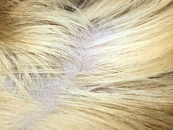 고양이탈모증상