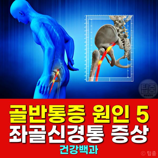 골반통증 원인 좌골신경통 증상