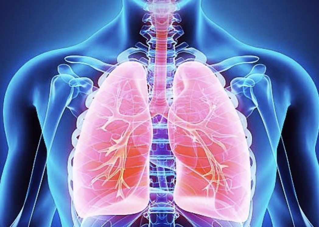 간유리음영 종류와 원인, 증상들