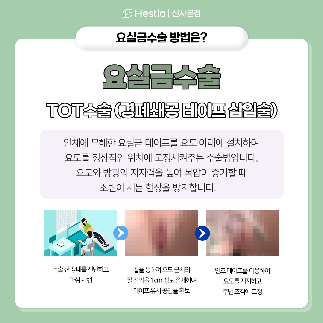 요실금수술이란?