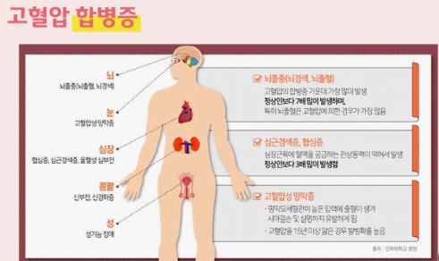 고혈압으로 인해 함께오는 잘병들 관련사진