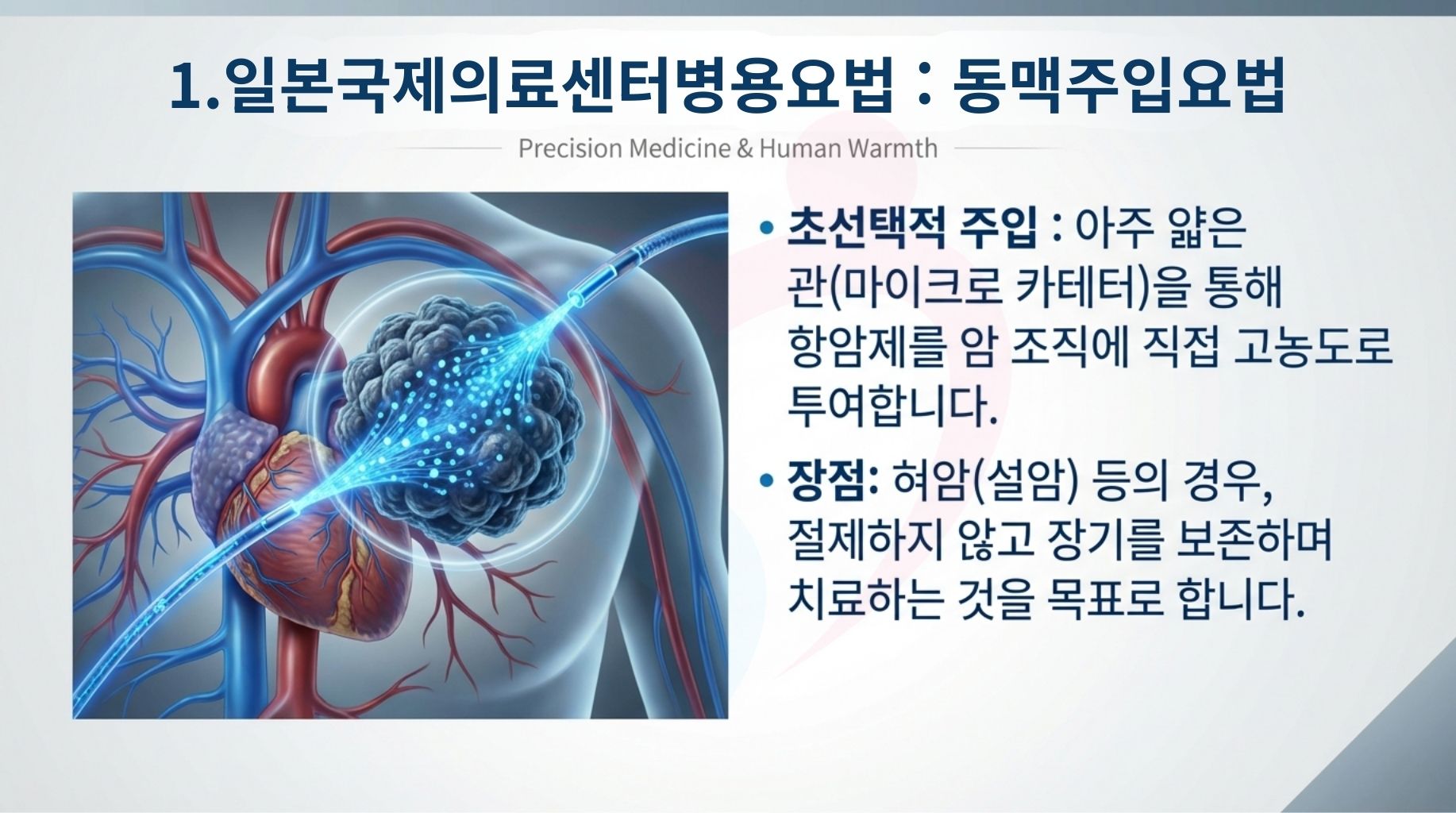 일본 중부국제의료센터 양성자치료 최신장비 ProBeam360