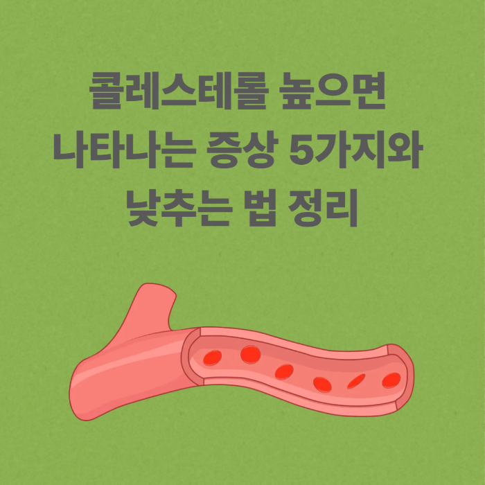 콜레스테롤 높으면 나타나는 증상 5가지와 낮추는 법 정리
