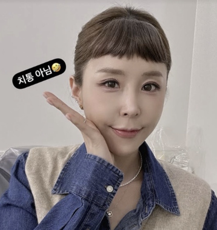 신지 쌍꺼풀 재수술 