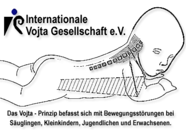 보이타 치료가 필요한 사람은 누구일까