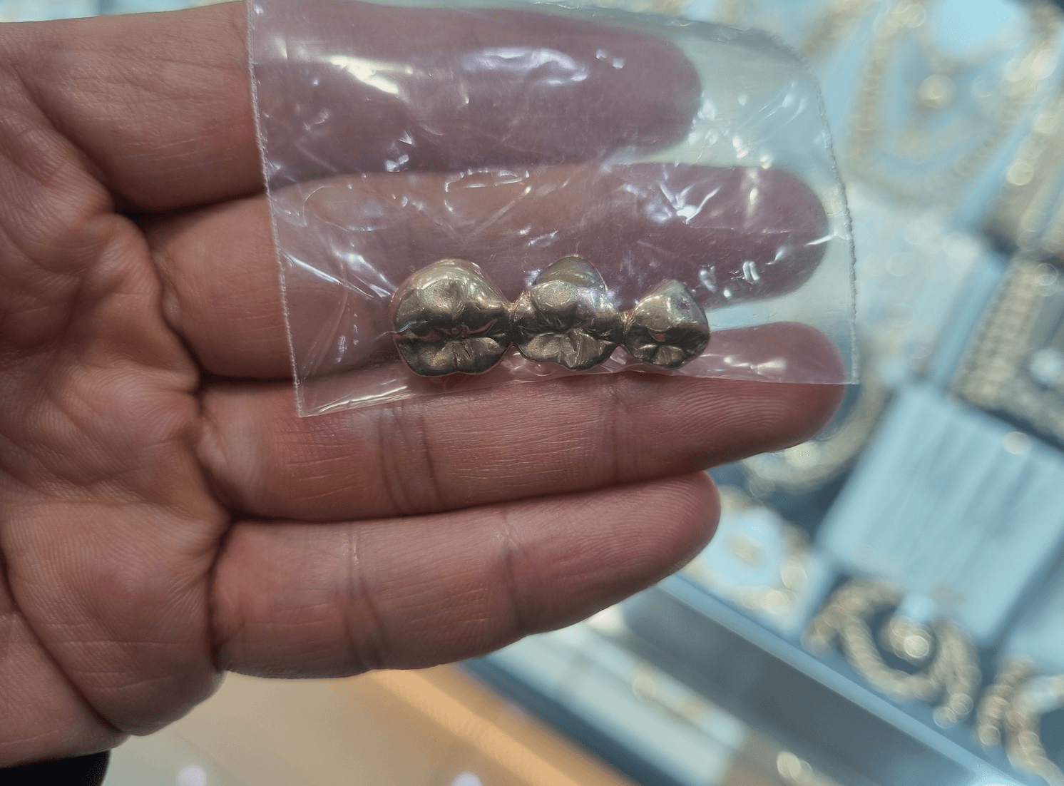 금니 판매 후기