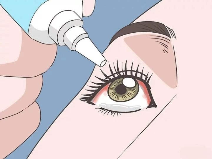 눈 실핏줄 터지는 이유 원인 결막하 출혈 자주 터지는 이유 치료방법