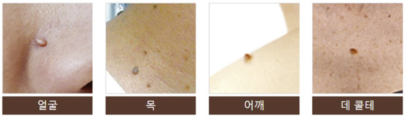 쥐젖