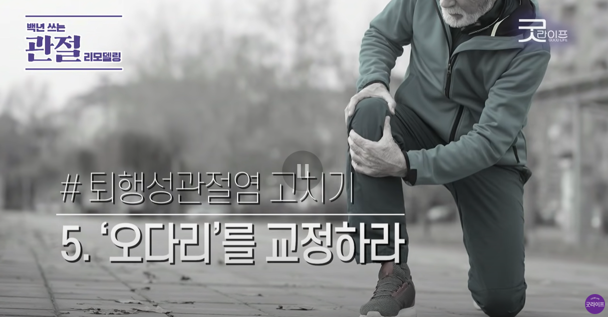 오다리를 교정하라