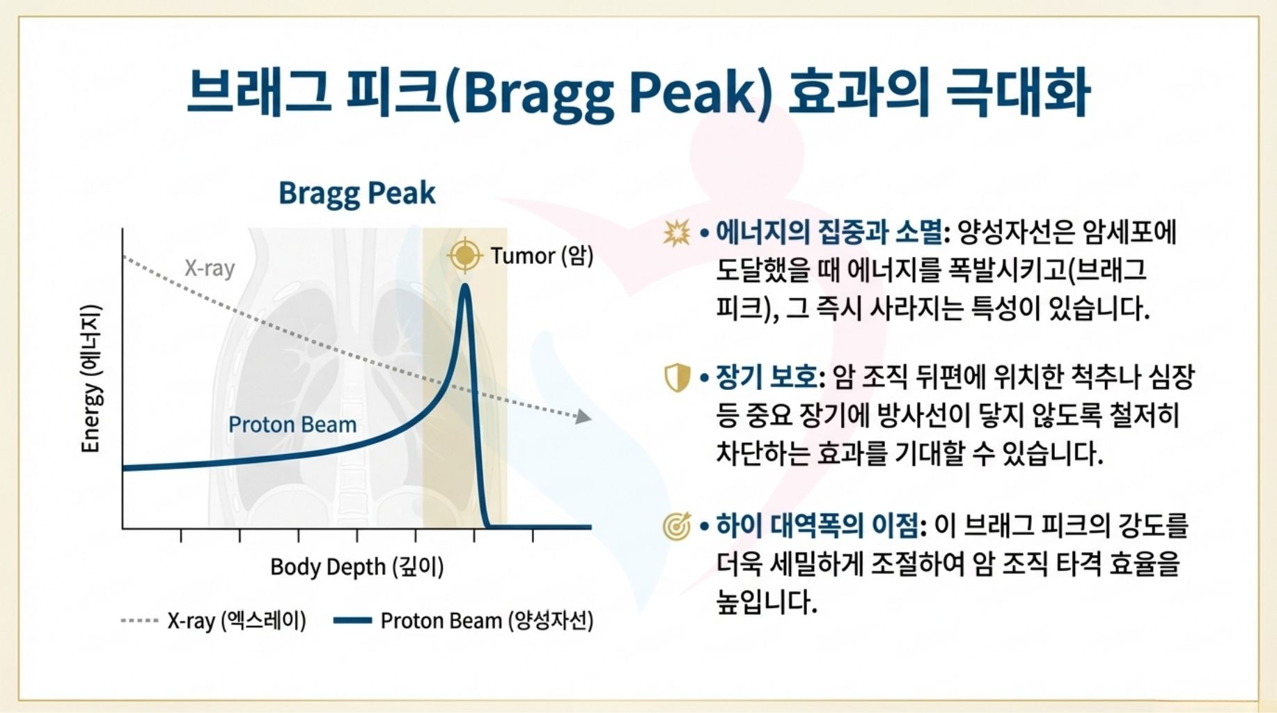 일본 중부국제의료센터 양성자선 치료의 특징