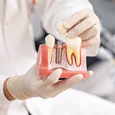 치과 치료비 건강보험 적용 범위 체크하기