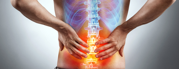 디스크 악화시키는 생활습관 7가지(의사들이 말하는 주의점)