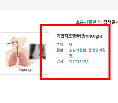 신장 검사방법 알아보기
