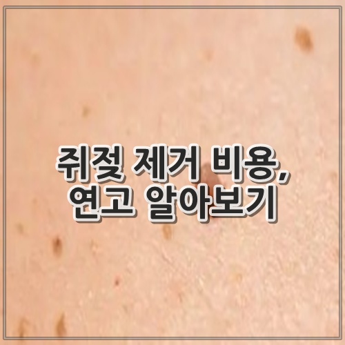 쥐젖 제거 비용, 연고 알아보기
