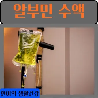 알부민 수액 알부민 링거 가격까지 한번에 정리로_4