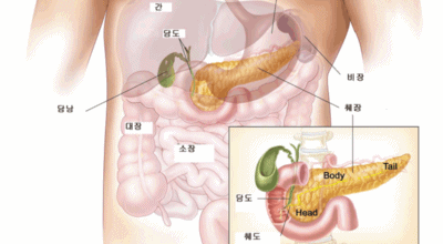 췌장에좋은음식이미지
