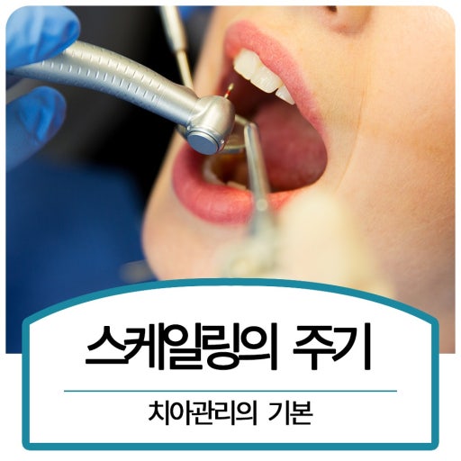 치아 스케일링 관련 사진