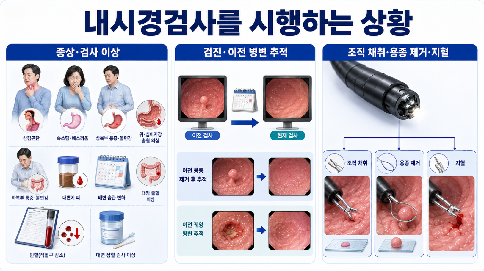 증상과 검사 이상&middot;이전 병변 추적&middot;조직 채취와 내시경 처치를 구분한 안내