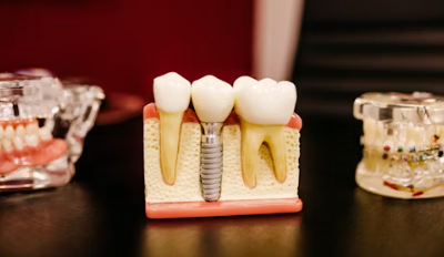 라이나생명 치아보험 청구서류 해지 보장내용