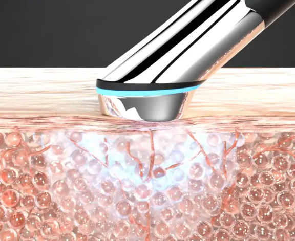 김희선 에이지알 부스터 힐러 후기