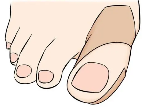 테이핑으로 고정하다