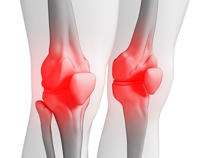 무릎 굽힐때 통증 치료