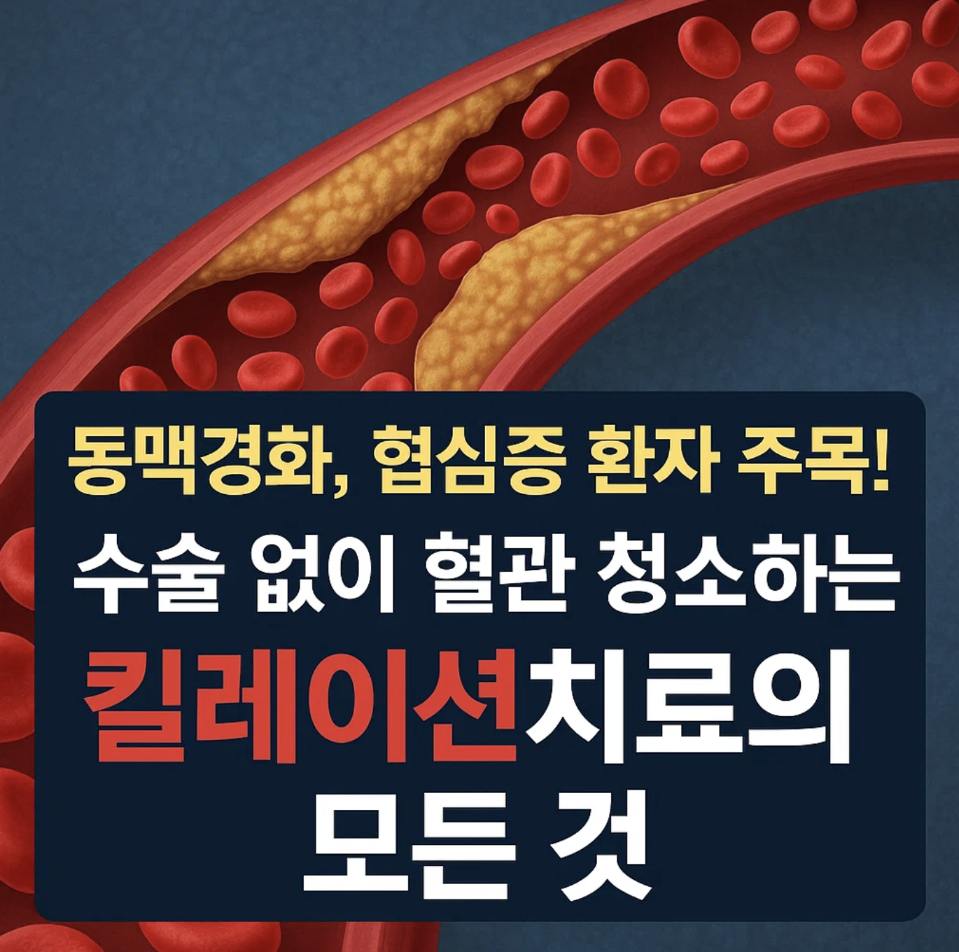 동맥경화, 협심증 환자 주목! 수술 없이 혈관 청소하는 킬레이션치료의 모든 것