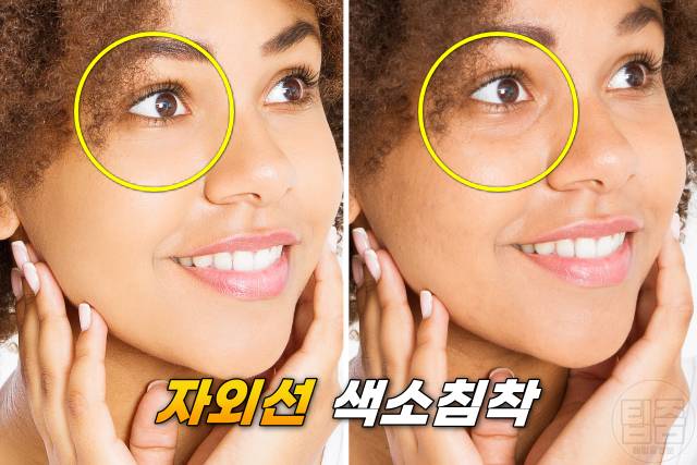 다크서클 원인 아이크림 추천 눈밑처짐 눈밑지방