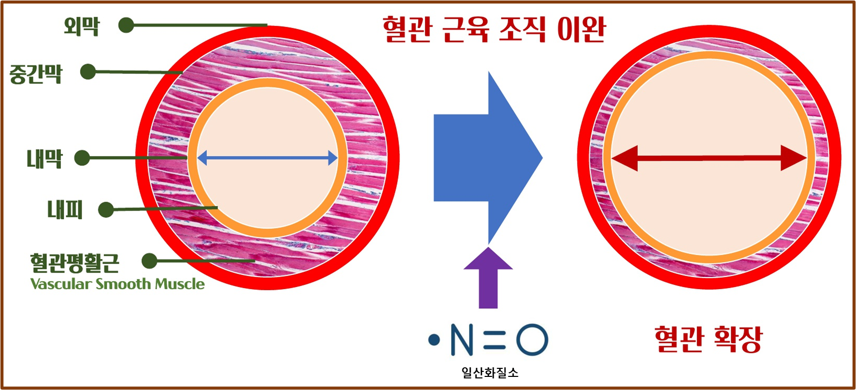 혈관 확장