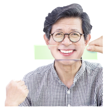 수면 임플란트 비용 과정