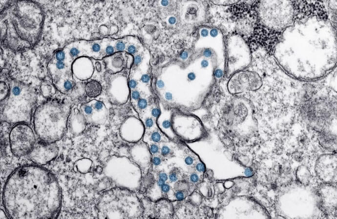 A형 간염 바이러스 이미지