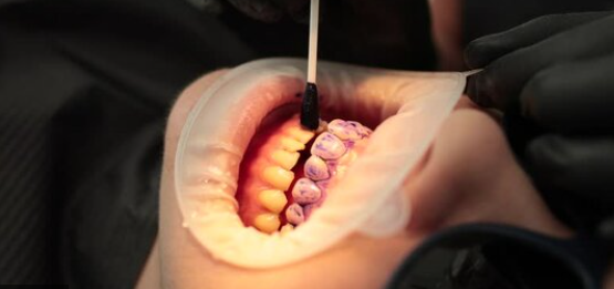 스케일링 이미지/출처:어도비스톡