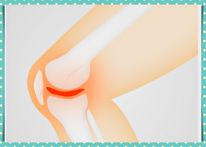 허리 협착증에 좋은 운동