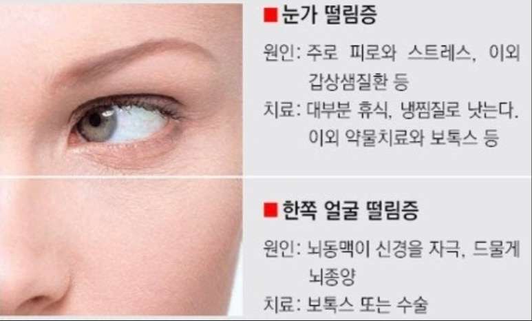 눈 떨림 상세설명 홍보 이미지