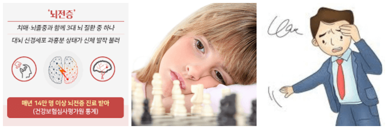 뇌전증, 멍 때리는 아기, 어지러워하는 사진