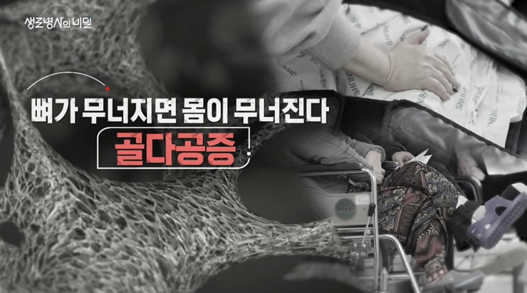 골다공증-생로병사의비밀